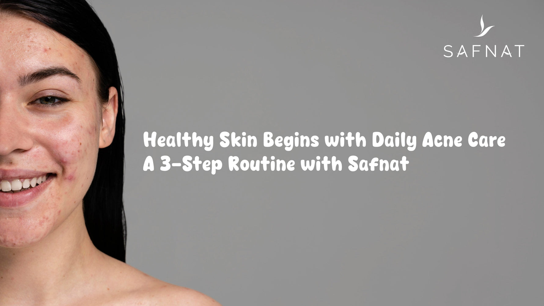 Healthy Skin Begins with Daily Acne Care – 3-Step Routine with Safnat Acne Control Combo